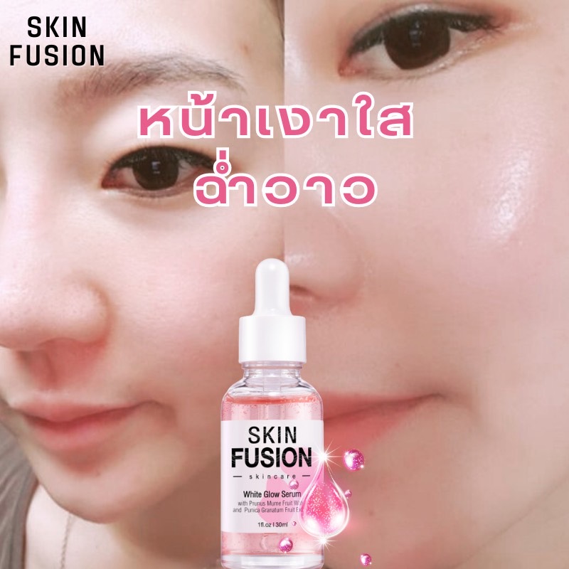 Skin Fusion เซรั่ม หน้าใส ดูแลผิวกระจ่างใส แก้หมองคล้ำ White Glow Serum 30ml ฝ้าแดด หน้าขาว เซรั่มบำรุงหน้า ลดจุดด่างดำ