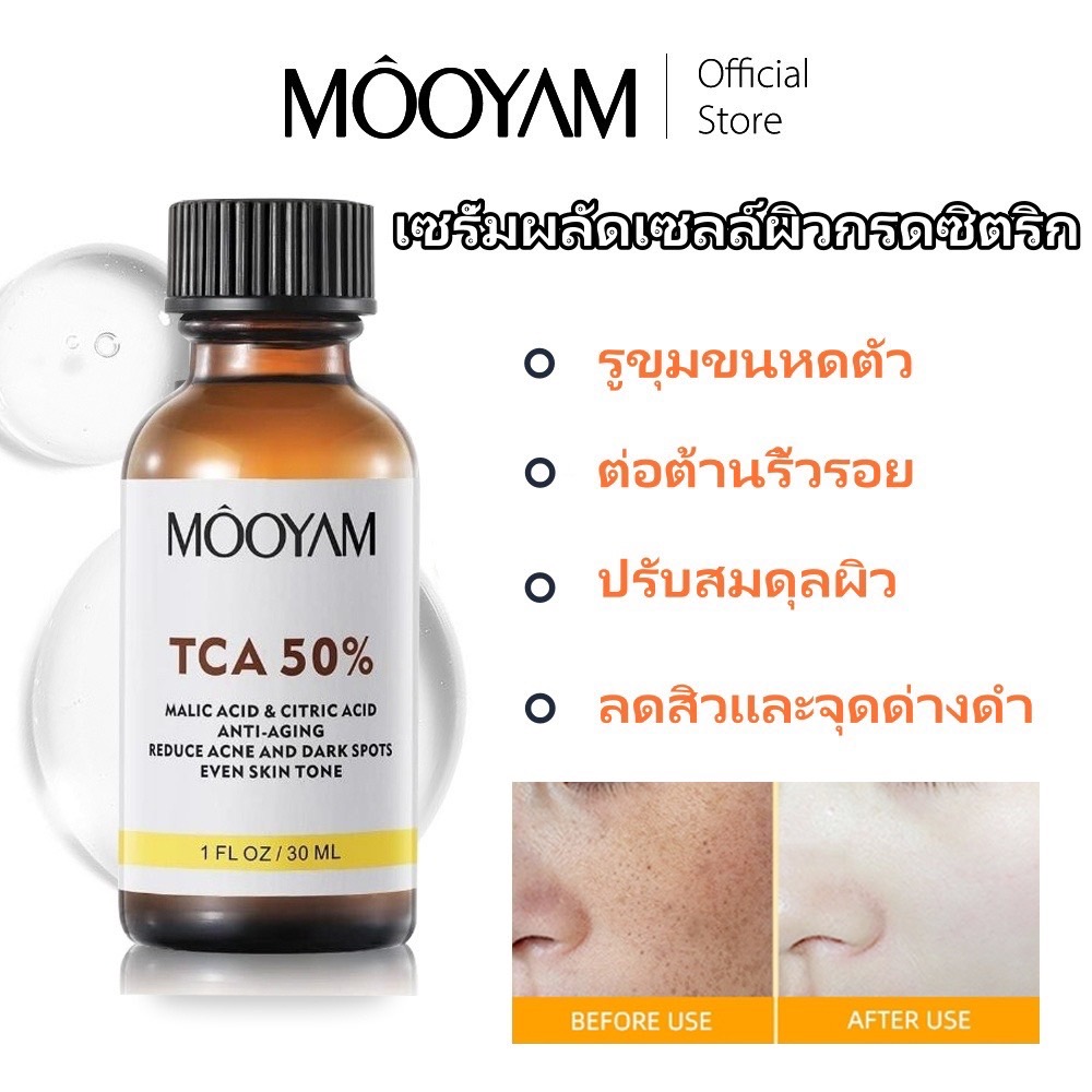 MOOYAM 50% TCA Acid Peeling Serum สารละลายกรดซิตริกสำหรับผิวหน้าผลิตภัณฑ์ดูแลผิวหน้า ลดสิวและจุดด่างดำสีผิวสม่ำเสมอ 30ml